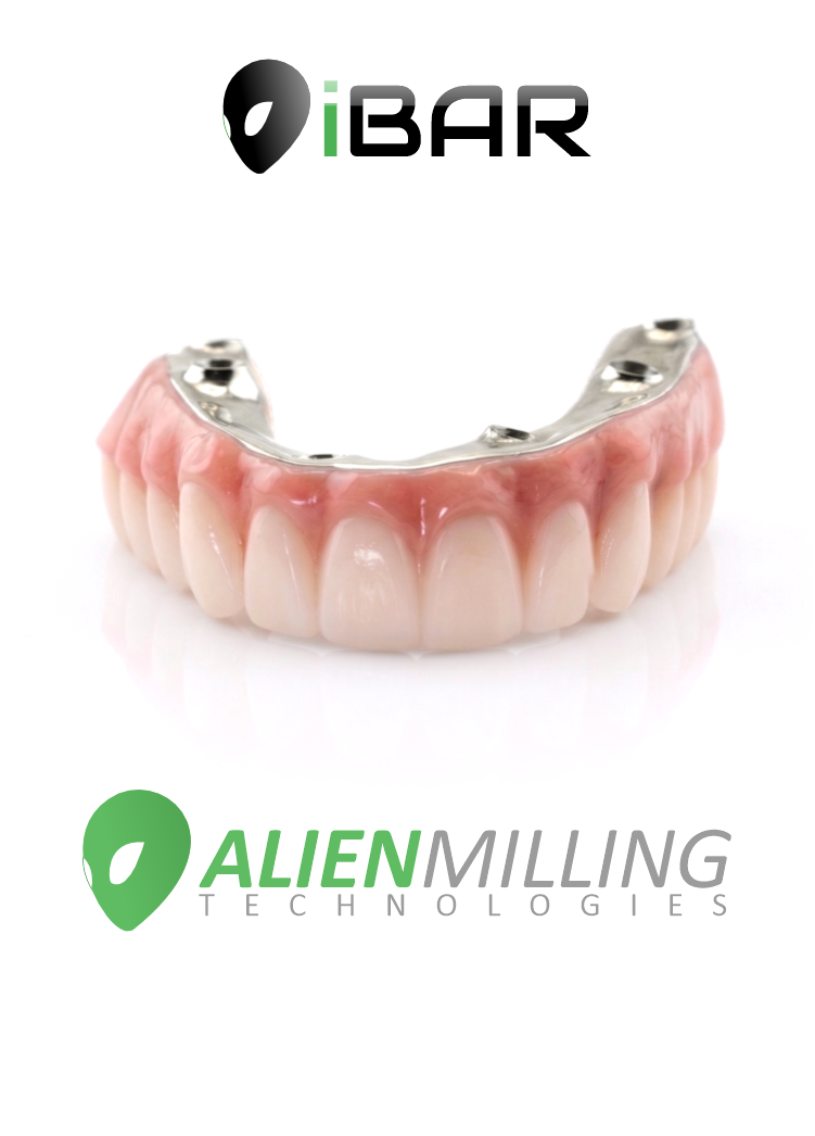 Alien Milling Full Arch Hybrid